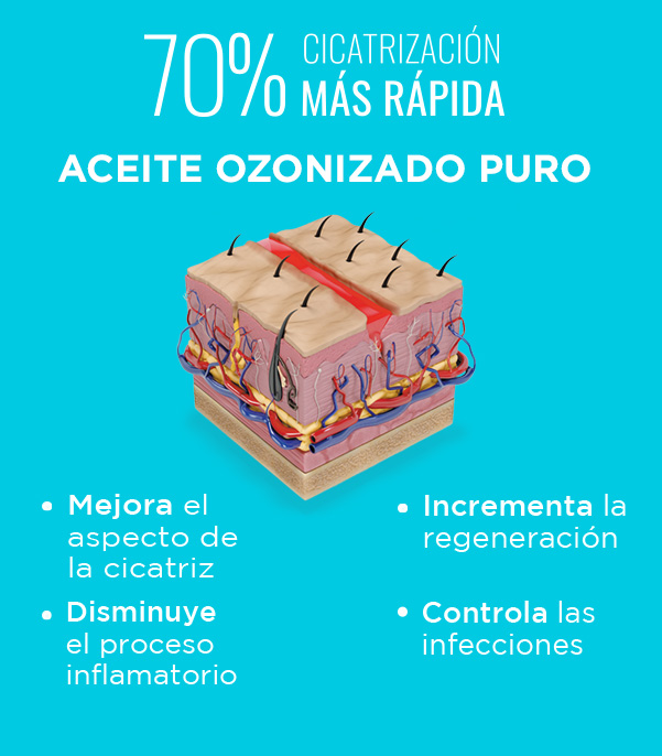 Beneficios del aceite ozonizado